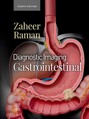 cover image of Gastrointestinal